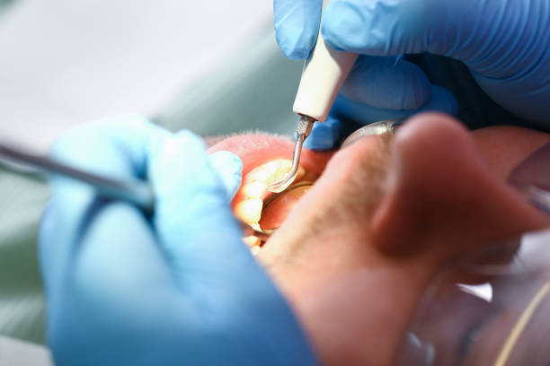 Best Orthodontic Emergency Dentist in Teays Valley, WV