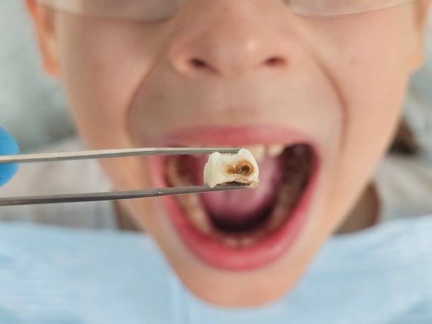 Best Weekend Emergency Dentist in Teays Valley, WV
